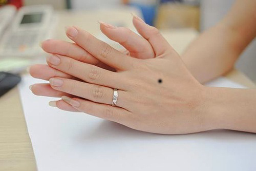 Nốt ruồi mu bàn tay nữ thường gặp nhiều may mắn