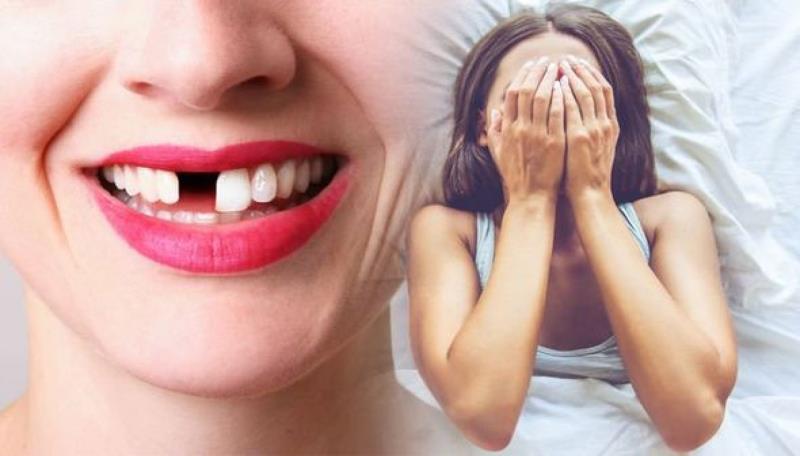 Nằm mơ thấy răng rụng là điềm báo tốt hay xấu?