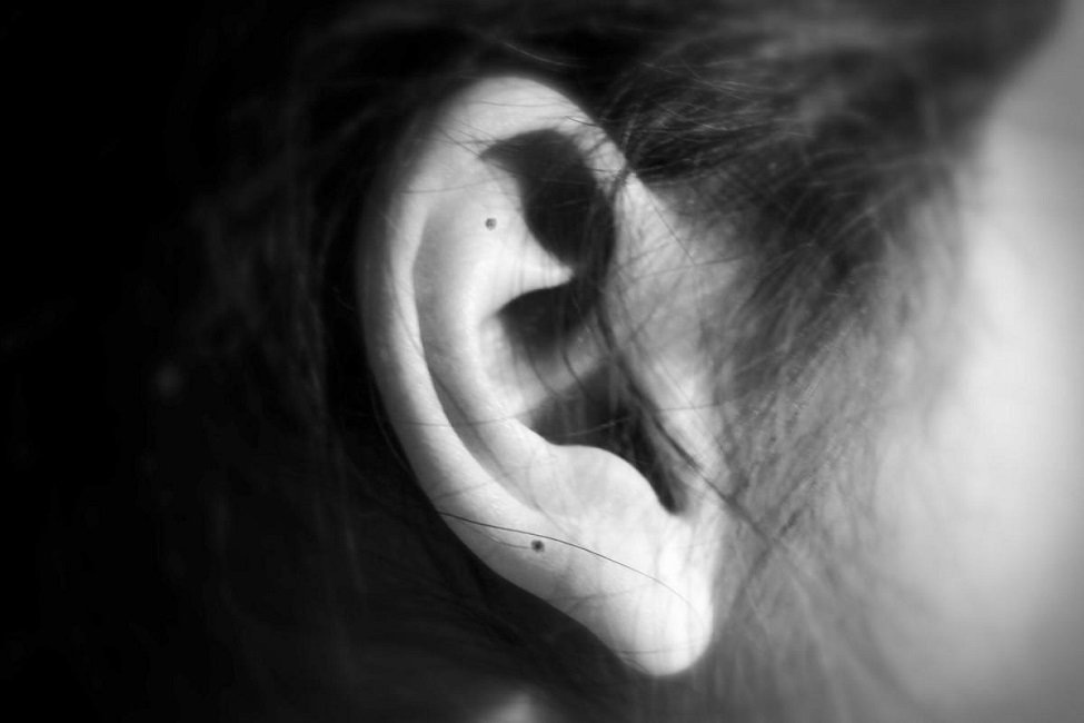 Nốt ruồi ở tai nam nữ có ý nghĩa gì giải mã vận tướng kinh nghiệm